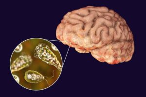Brain-Eating Amoeba Outbreak in Kerala